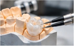 Dentallabor mit Inlay und Zahnersatz
